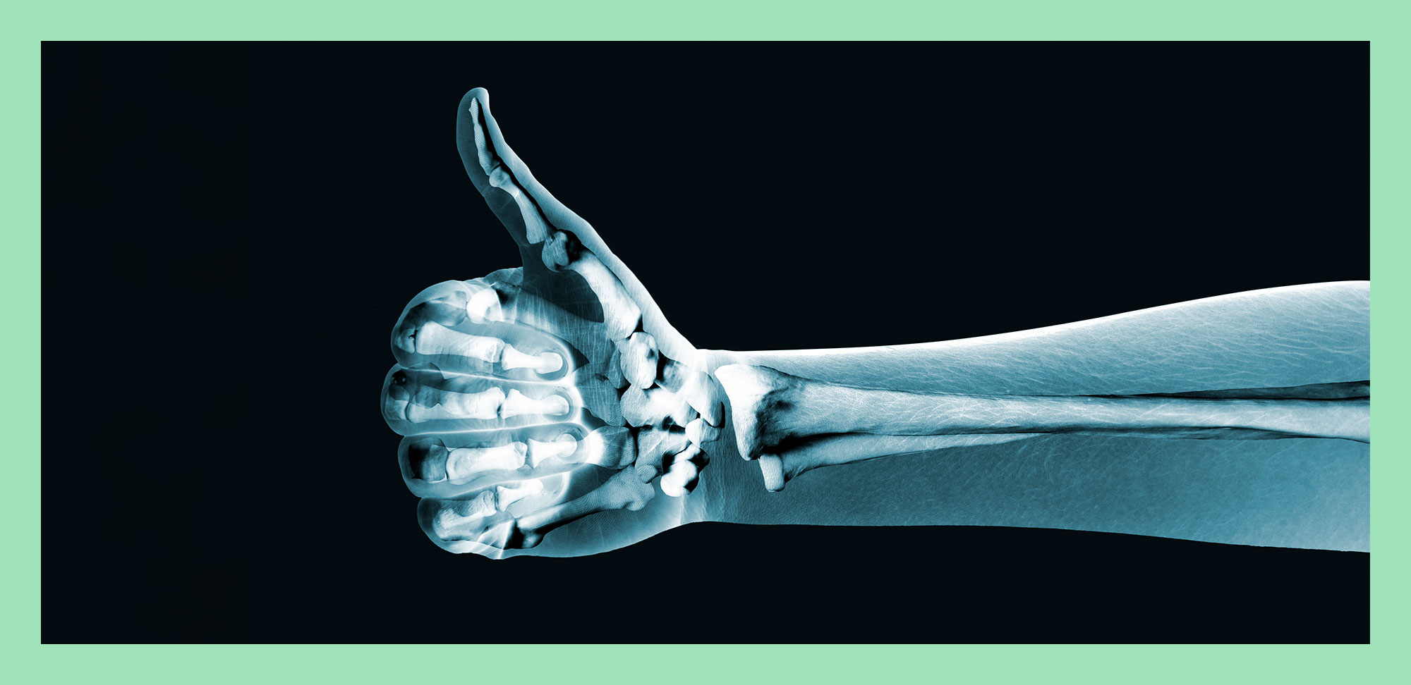 Photo of x-ray hand on black background